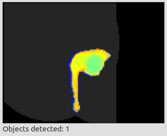 Detected person with fist